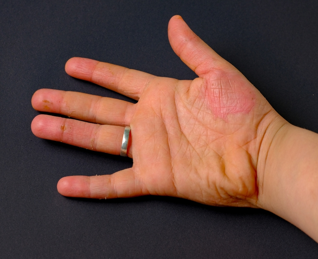 Healthcare consultation